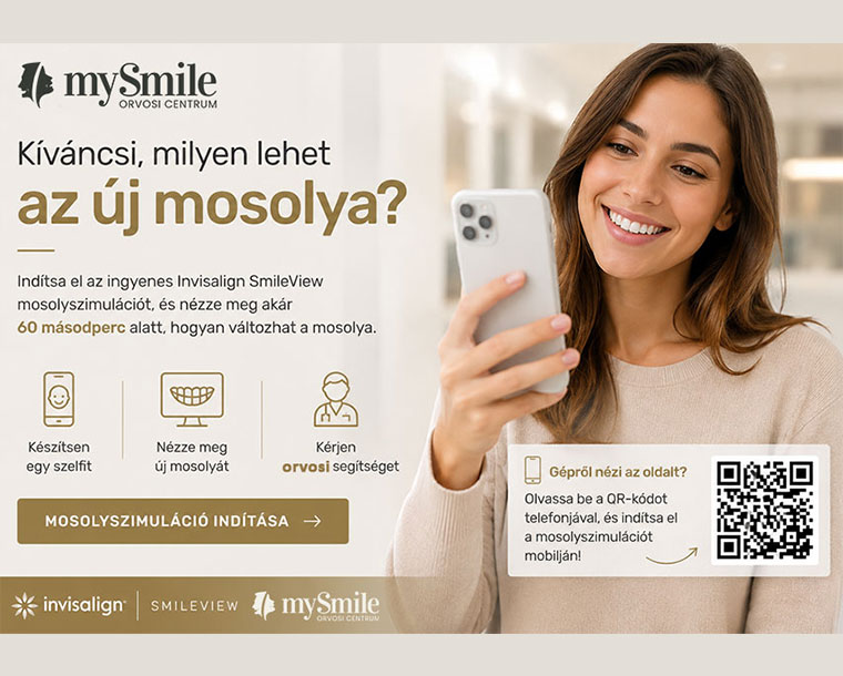 Mosolyszimuláció