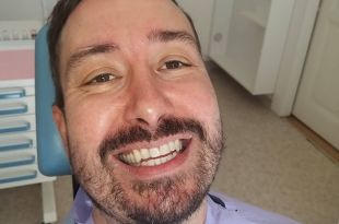 Láthatatlan fogszabályozás 10 hónap